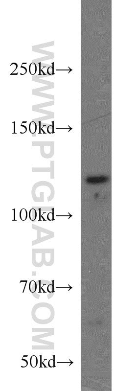 PPP1R15B antibody (14634-1-AP) | Proteintech