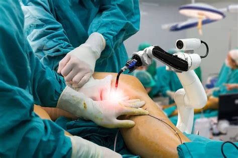Robotic Knee Replacement | Orthopod – Revolutionizing Joint Surgery