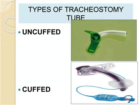 Tracheostomy | PPT