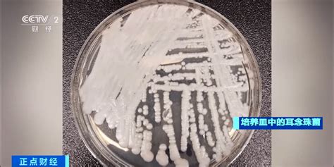 普通生物显微镜可以看真菌菌丝吗？