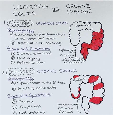Ulcerative Colitis Endoscopy
