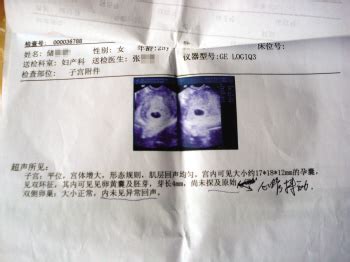 胎儿正常医院却称是死胎 被曝后称检查结果不同_新闻中心_新浪网