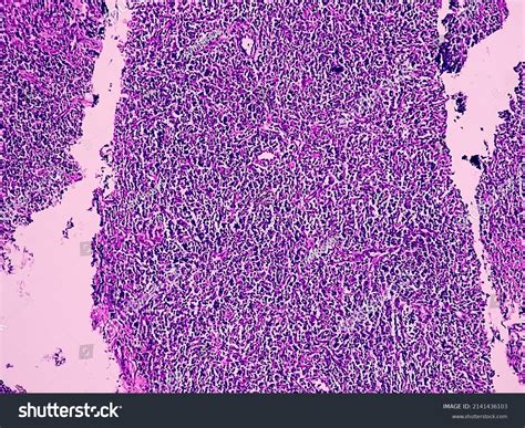 Non Invasive Blood Test Images: Over 4 Royalty-Free Licensable Stock Photos | Shutterstock