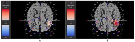 Individual Differences in the Neurocognitive Effect of Movement During ...