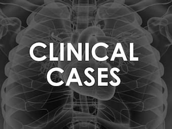 Image result for Clinical Data Management System