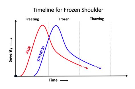 Phases Of Frozen Shoulder