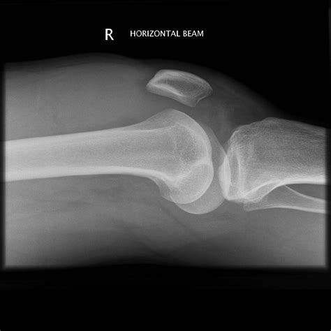 All Things Patella
