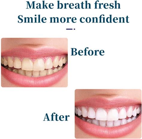 Rezebu Sp-7 Probiotic Toothpaste, Sp7 Toothpaste, Sp-7 India | Ubuy
