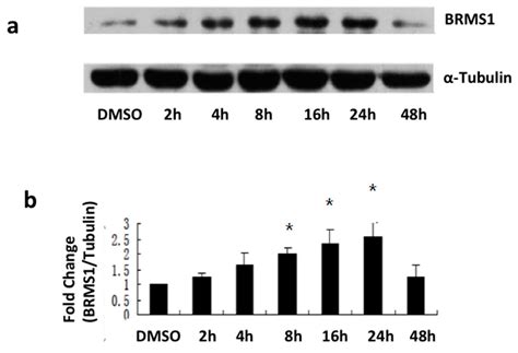 ERα Mediates Estrogen-Induced Expression of the Breast Cancer ...