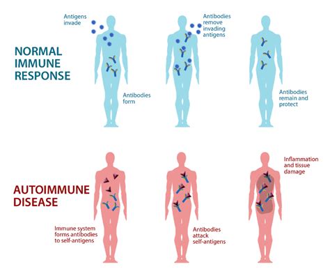 Autoimmunity 的图像结果