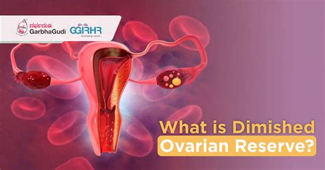 What Is Diminished Ovarian Reserve? | GGIRHR
