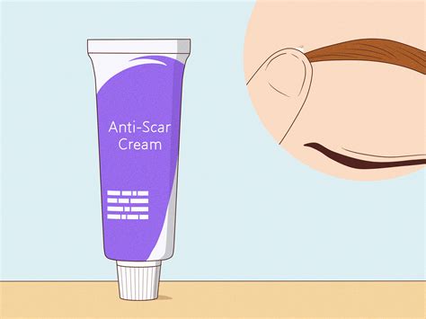 Eyebrow Piercing Scar How To Identify And Get Rid Of Keloids Caused By