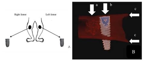 Osteoproductivity of Injectable Bone Grafts with and without Ostrich ...