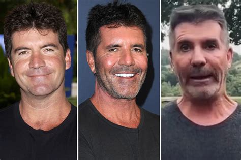 Simon Cowell's Face: Then and Now with Plastic Surgery Discussions