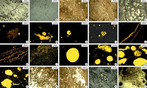 Mental maladies and the role of our immune system | Research Matters