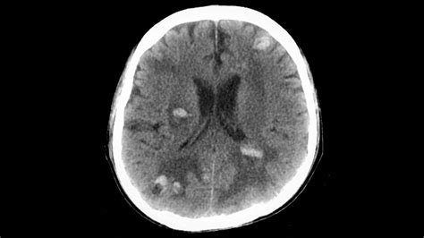 Endocrinology News | MedPage Today