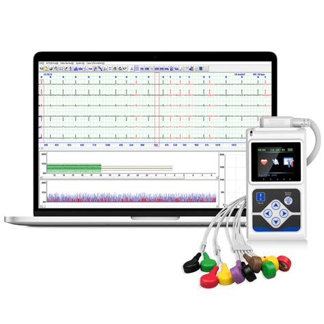 Mobile 6/12-Lead EKG/ECG Machine Fits into Your Pocket, with Auto Interpretation, Wirelessly ...