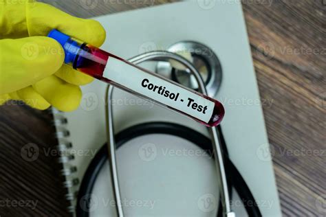 Cortisol Blood Test Bottle Colour at Evelyn Vaughn blog