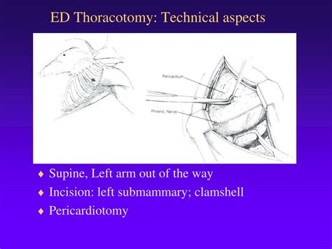 Image result for Clamshell Procedure