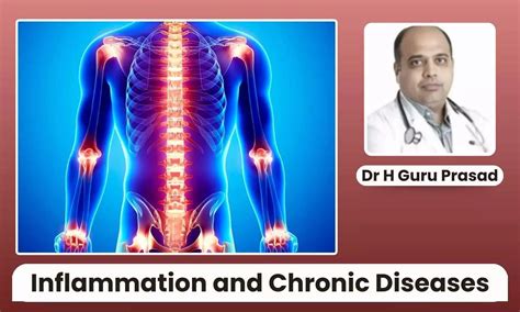 Link Between Inflammation and Chronic Diseases: Key Causes, Blood ...