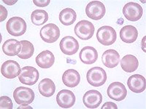 Image result for Target Cells