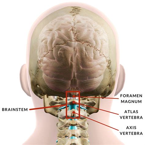 Text Neck and the Upper Cervical Spine — Jarek Esarco, D.C.