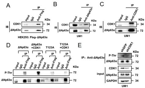 CDK1 Promotes Epithelial–Mesenchymal Transition and Migration of Head ...