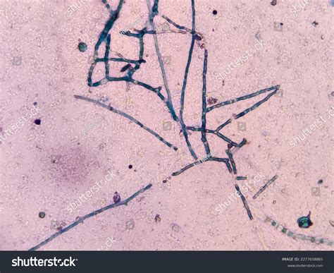 Characterization Rhizopus Spp Under Light Microscope Stock Photo ...