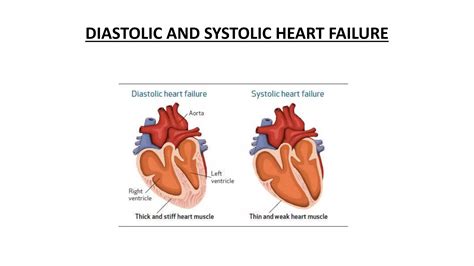 Classification and clinical features of congestive heart failure | PPTX