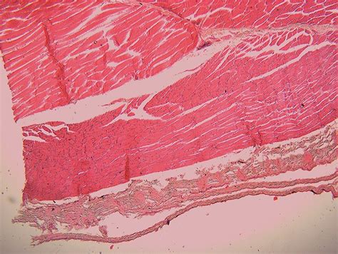 Histology of Fish: Muscle and Skeleton Muscle