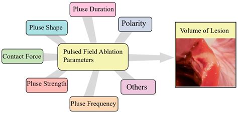 Potential Application of Pulsed Field Ablation in Ventricular Arrhythmias