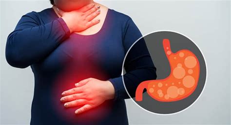 Acid Reflux: 12 Easy Home Remedies To Treat Gas And Acidity ...