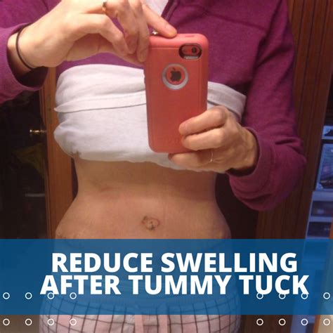 Why Can't I Sleep On My Side After A Tummy Tuck at Bob Wright blog