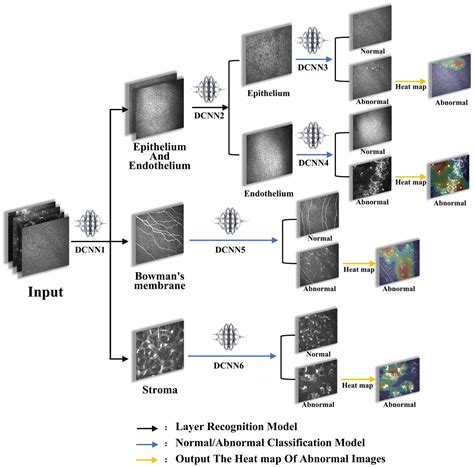 Frontiers | Evaluation of a computer-aided diagnostic model for corneal diseases by analyzing in ...