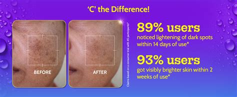 Chemist At Play 10% Vitamin C Face Serum |Brightens & Gives Glow |Fades ...