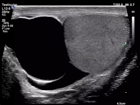 Philips - Affiniti 70 Ultrasound system