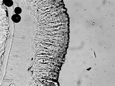 Surfactant therapy for respiratory distress syndromes