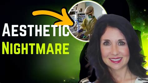 Cosmetic Surgery Nightmares: The Tragic Fate of Megan Espinoza - YouTube
