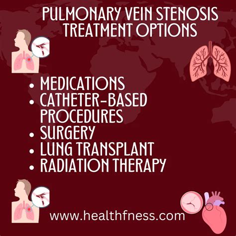 Pulmonary Vein Stenosis: Causes, Symptoms and Treatment 2023 | HealthFness