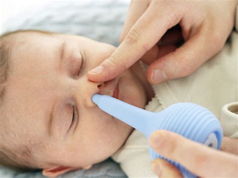 How to treat your baby's congestion | BabyCenter
