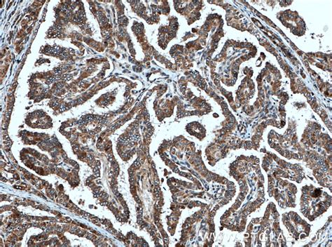 Endothelin 3 antibody (27871-1-AP) | Proteintech