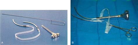 Synthetic Midurethral Slings for the Correction of Stress Incontinence - Clinical Tree