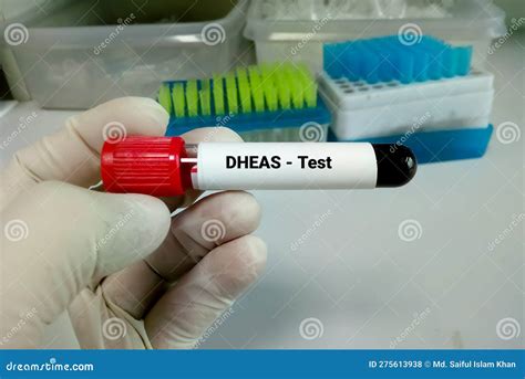 DHEAS (dehydroepiandrosterone Sulfate) Hormone Test Stock Photo - Image of health, estradiol ...