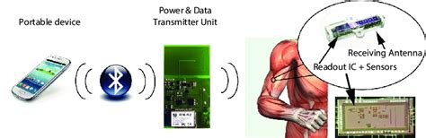 Image result for Subcutaneous Button Device