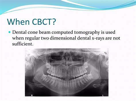 CBCT | PPTX