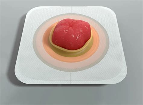 Stoma Care - Ileostomy, Urostomy & Colostomy Supplies - Convatec