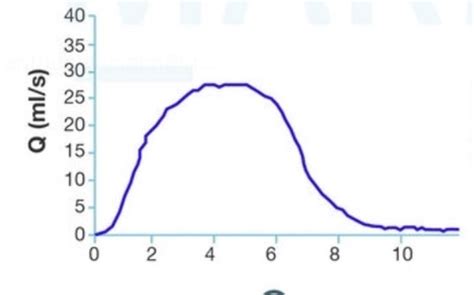 Surgery GT points Flashcards | Quizlet