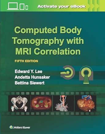 Buy Computed Body Tomography with MRI Correlation Book Online at Low ...