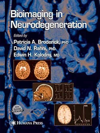 Buy Bioimaging in Neurodegeneration (Contemporary Neuroscience) Book ...