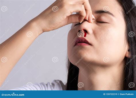 Bloody Nose Stock Image | CartoonDealer.com #4162789